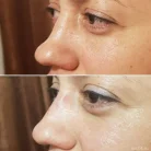 Клиника косметологии Ника Клиник Фотография 3