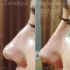 Клиника косметологии Ника Клиник Фотография 11